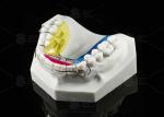 Customizable Spring Hawley Retainer Removable Teeth Position Retention