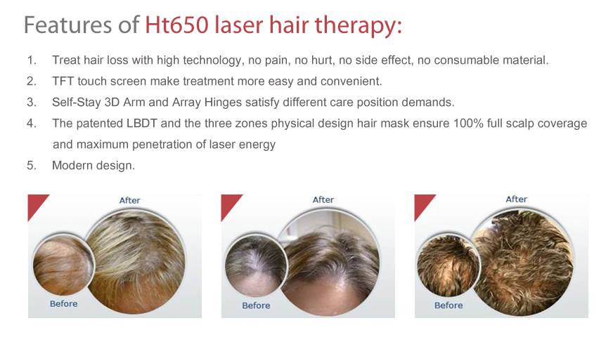 Diode Laser Hair Growth Machine 650nm Low Level LLLT Hair Loss Treatment