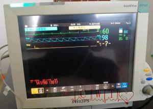 Wholesale 2nd Hand 50mm/S Hospital Monitoring System , 12 Inch Icu Bedside Monitor from china suppliers