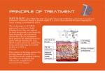 High efficient Chinese manufacturer 150w output power fat reducing treatments
