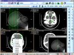 8 x 10inch Medical Paper Laser X Ray Diagnostic Imaging For KND-DRYTEC 4000