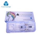 2ml Injectable BDDE Cross Linking Hyaluronic Acid Filler Injection For Lip