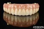 Transform Your Dental Restoration With Ti-Bar Zirconia Hybrid Bridge Durable And