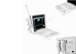 Full Digital Portable Color Ultrasound Scanner Economical Color Ultrasound