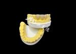 Upgrade Your Dental Aesthetics with a Ceramic Crown Bridge that Combines