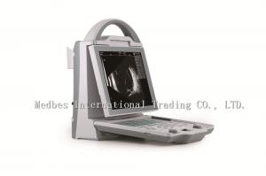 China Top Sale Laptop Ophthalmic AB Mode Ultrasound Scanner Equipment on sale