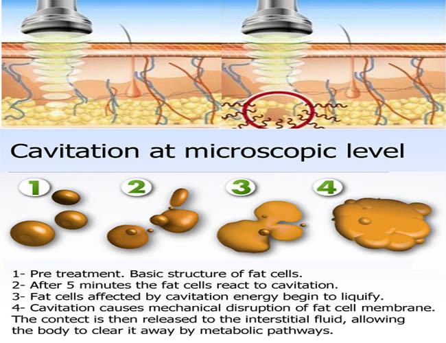 Portable 4D Cavitation Slimming Machine Weight Loss 40KHz