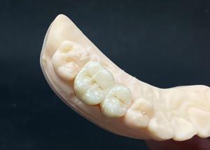 Wholesale High Translucency Zirconia Crown Natural Looking Design with Chipping Resistance from china suppliers