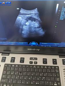 Wholesale Mindray Laptop Original Ultrasound System M9 Curved array from china suppliers