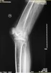 KND-A Low Fog Medical Dry Imaging Film For X Ray Examination On AGFA 5300, 5302,