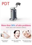 Compact Size Photodynamic Therapy Machine For Wrinkle Removal High Safety