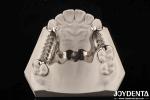 Clinical Practice Dental Alloying Metal Framework Good Fit In The Mouth