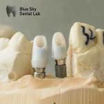 Single Crowns Zirconia Abutment Hypoallergenic Dental Implant Zirconia Abutment