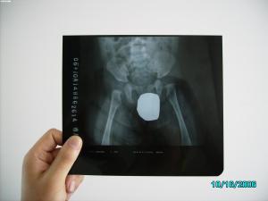 Wholesale Silver Halide Laser X Ray Medical Imaging Waterproof Thin Agfa DRYSTAR DT1B / DT2B from china suppliers