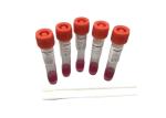 Flocking-01 10ml Virus Specimen Collection Tube With Flocked Swabs VTM Kits