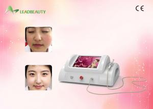China Radio frequency Ablation Varicose Veins / Spider Vein Removal Painless 30Mhz on sale