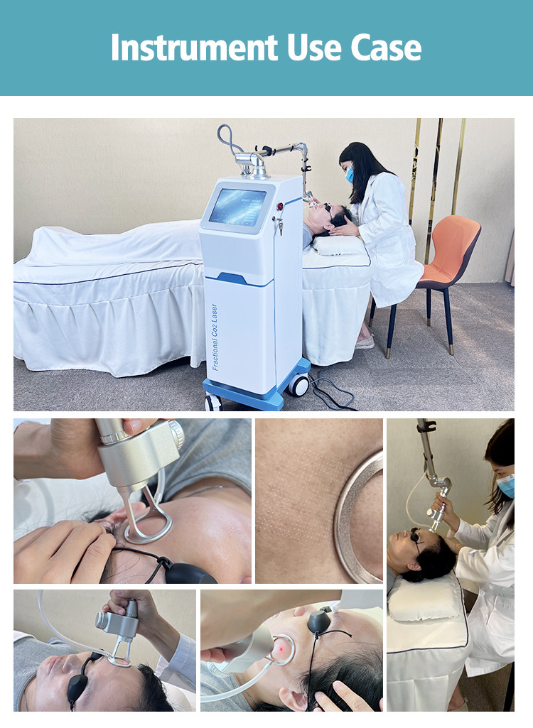 DDP Shipping CO2 Fractional Laser Machine With 0.1ms-10ms Pulse Width 109X50X40 Cm Net Size