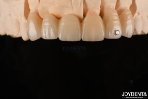 Wholesale CAD / CAM Milling Dental Layered Zirconia For Single Crowns 0.3-0.5mm Layer Thickness from china suppliers