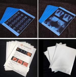 Wholesale Medical X Ray Film Dry Thermal Film for Clear Imaging from china suppliers