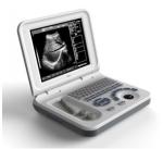 Wireless Color Handheld Ultrasound Probe Scanner Digital Ultrasound Cardiac