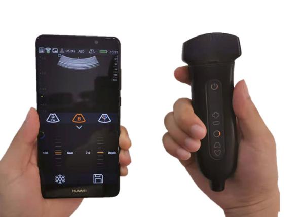 Ultrasound Tranducer Handheld Ultrasound Scanner Compatible To Windows / Android