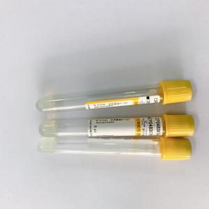 Wholesale Non Vacuum Gel And Clot Activator Tube Good Compatibility Easy To Use from china suppliers