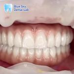 Nature Design Dental Implant Case Implant Operation Cases For Multiple Choices
