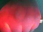No Radiation Strong Red Light Infared Vein Finder With Mobile Rechargeable
