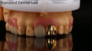 Wholesale Full Acrylic Dentures With Yellow Gold Teeth/Dental Temporary Acrylic Denture Ivoclar Professional FDA Approved from china suppliers
