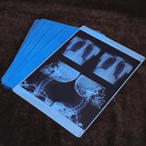 Wholesale Medical Based Dry Imaging Xray Film For Making X-ray Film from china suppliers