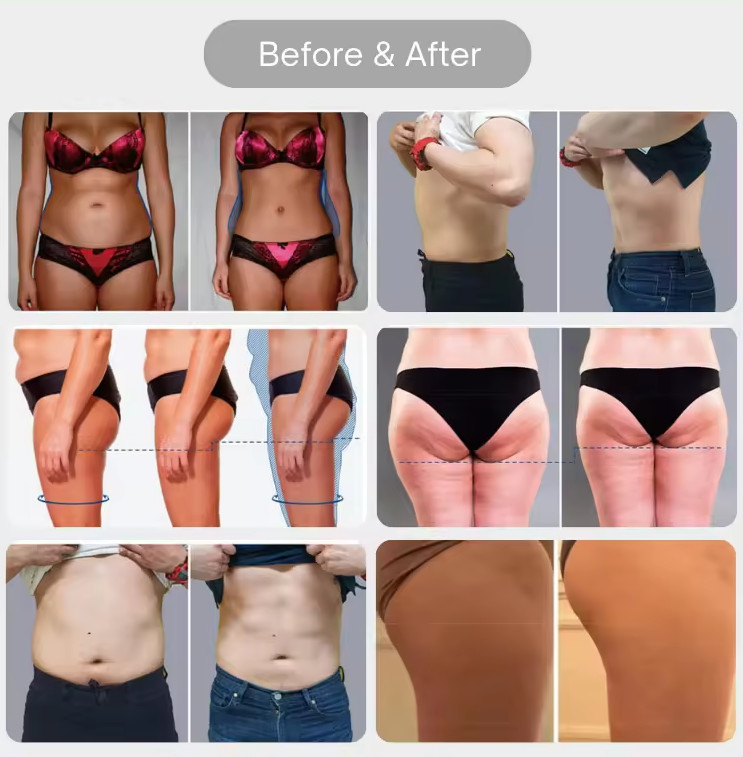 Portable 4 Handle Ems Slim Circslim Contouring Neo Rf Hi Emt Sculpting Machine