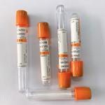 Laboratory Vacuum Pro Coagulation Tube For Rapid Serum Biochemical Test