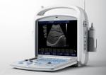 Medical Ultrasound Machine Portable Ultrasound Scanner 4d Ultrasound Equipment