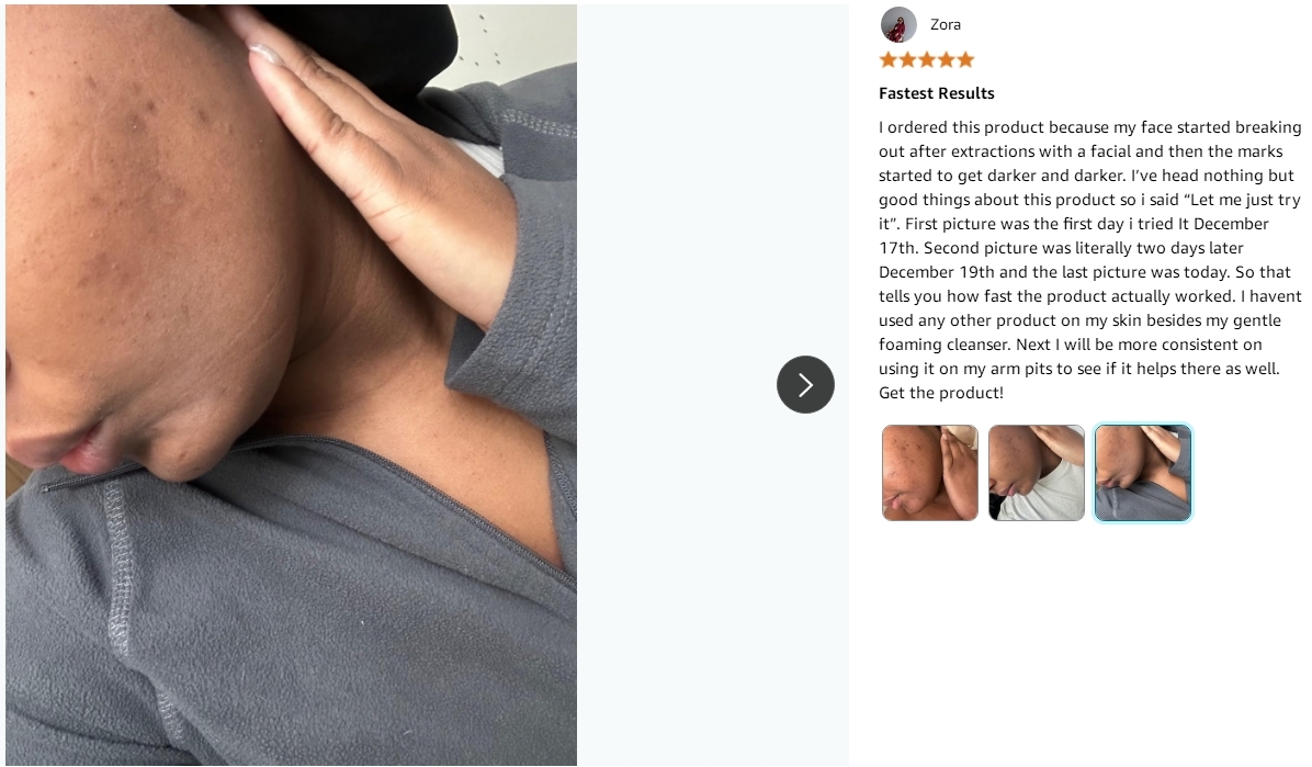 Alcohol Free Skin Molecules Discoloration Correcting Serum Tranexamic Acid Niacinamide For Dark Age Spots