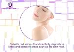RF Cellulite Melting Cavitation Lipo Laser Slimming Machine For Man And Woman