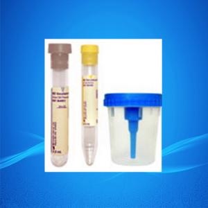 China Urine Container/Urine Specimen Cups/Urine Cups on sale