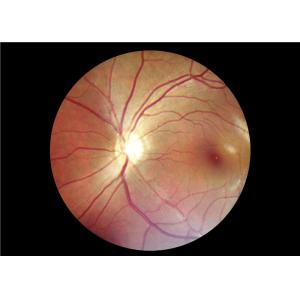 Wholesale Handheld Digital Fundus Camera from china suppliers