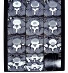 Transparency Digital X Ray Film , Medical Imaging AGFA / Fuji X Ray Dry Film