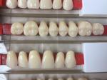 Acrylic Resin Denture Teeth Set Repair Surfaces 2 Layers Super Hard Synthetic