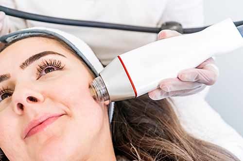 Popular Ce Fractional Rf Microneedle Machine Noninvasively