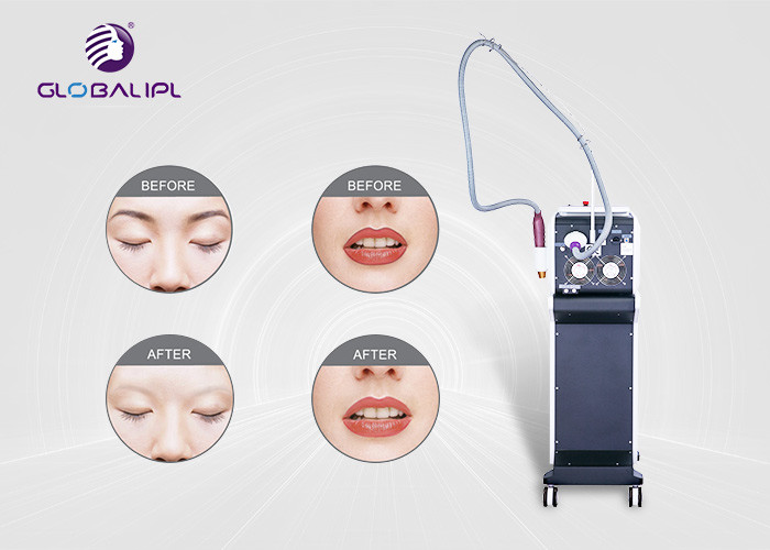 Nd Yag Laser Tattoo Removal Equipment Pico Laser Beauty Machine 1064nm / 532nm Wavelength