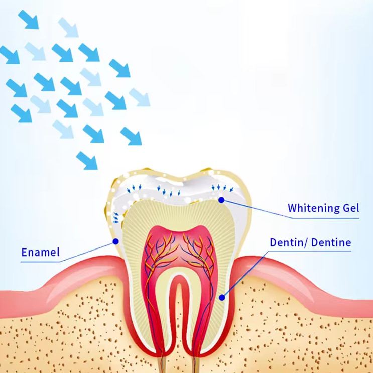 Home Use Led Light Teeth Bleaching  Improve Tooth Yellowing Tooth Whiter Tool