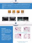 Beauty cavitation slimming machine hifu body high intensity focused ultrasound
