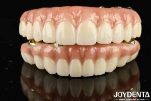 Wholesale High Durability Ti-Bar Zirconia Hybrid Bridge The Ultimate Choice for Achieving Aesthetics That Last from china suppliers