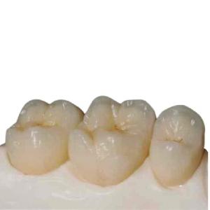 Wholesale High Strength Zirconia Ceramic Teeth Precision Digitally Manufactured from china suppliers