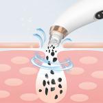 ABS Vacuum Blackhead Remover Face Beauty Instrument For Pigment Decomposition