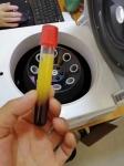 TD4D Low Speed PRP Centrifuge 4000rpm 5ml 10ml 15ml 20ml