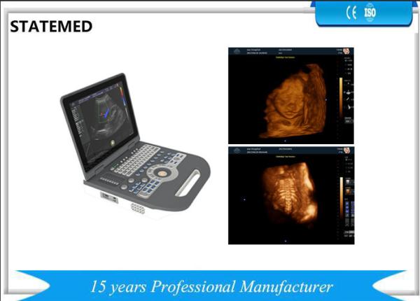 36.9×38×79 CM Laptop Ultrasound Scanner / 6.5 Kg Portable Baby Ultrasound