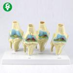 China Four Stage Pathological Human Joints Model / Learning Knee Model Anatomy for sale
