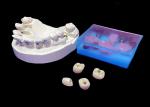 Customizable Polished Dental Implant Crown Bridge Long Lasting for Easy Hygiene